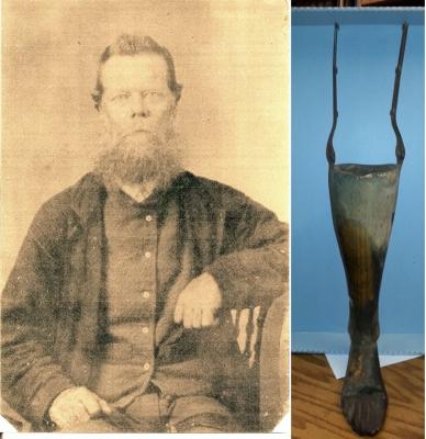 Left, sepia photo of man sitting in a chair. Right, prosthetic lower leg.